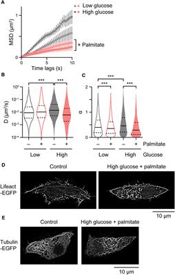 Single-molecule analysis of intracellular insulin granule behavior and its application to analyzing cytoskeletal dependence and pathophysiological implications